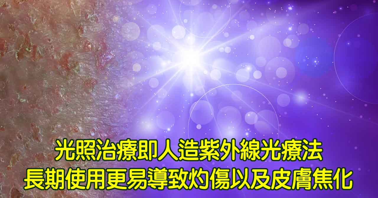 光照療法中醫治療